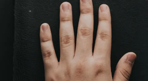 Hand auf dunklem Untergrund, vorbereitet für die Fingerabdrucknahme